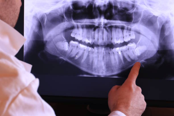 Best Emergency Dental Surgery in Des C, AR